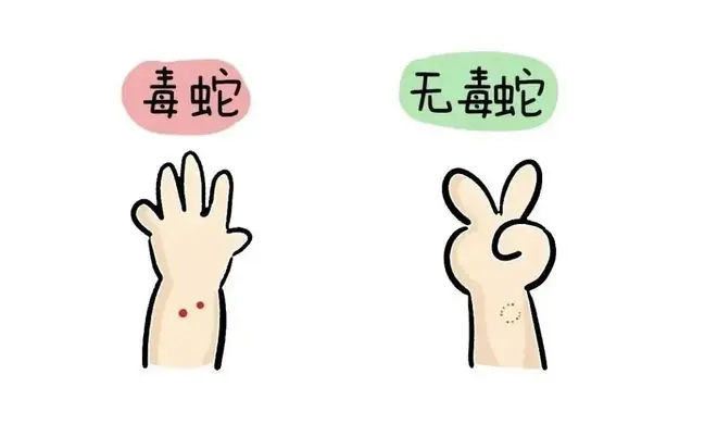 毒蛇的咬痕一般表现为1—4个出血点，多数情况为2个；无毒蛇为两排细小牙痕 图源：青岛卫生健康